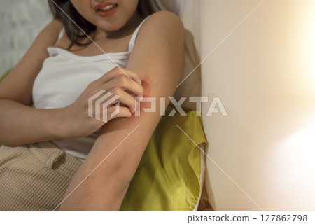 Indonesian southeast asian woman suffering from skin allergy, scratching her itchy and rash skin with her fingers. Healthcare concept Indonesian southeast asian woman suffering from skin allergy, scratching her itchy and rash skin with her fingers. Healthcare concept 127862798