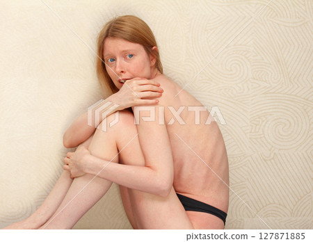 Anorexia nervosa Anorexia nervosa 127871885