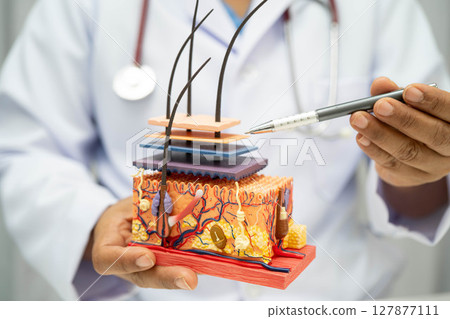 Hair transplant, Asian dermatologist doctor holding skin structure anatomy model for treatment in hospital. 127877111