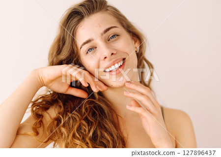 Portrait of a beautiful woman with inflammations on the skin of her face. Medicine and cosmetology. 127896437