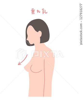 乳房下垂的女性的側面插圖 乳房下垂的女性的側面插圖 127918277