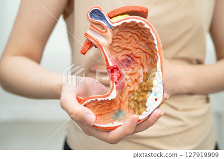 Stomach disease, Asian woman holding anatomy model for treatment in hospital. Stomach disease, Asian woman holding anatomy model for treatment in hospital. 127919909