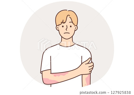 Man suffering from dermatitis and skin diseases with spots on hands needs help of dermatologist Man suffering from dermatitis and skin diseases with spots on hands needs help of dermatologist 127925838