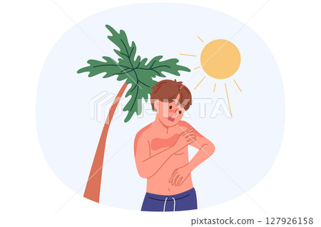 Boy received sunburn due to ultraviolet allergy or heliophobia, standing on beach with palm tree Boy received sunburn due to ultraviolet allergy or heliophobia, standing on beach with palm tree 127926158
