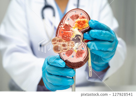 Chronic kidney disease, doctor with model for treatment urinary system, urology, Estimated glomerular filtration rate eGFR. 127928541