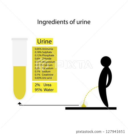 illustration of biology and medical, Ingredients of urine, The color of urine can tell the health, Urine color chart, Light and dark yellow, amber, brown, and red urine, Medical test analysis 127941651
