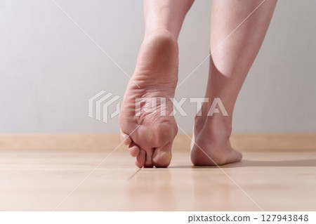 Woman's feet with dry and damaged heels, indicating urgent need for effective foot care and moisture therapy Woman's feet with dry and damaged heels, indicating urgent need for effective foot care and moisture therapy 127943848