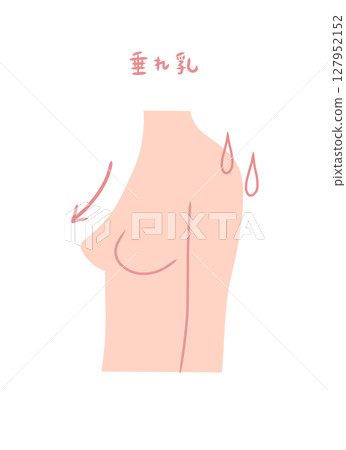 乳房下垂的女性的側面插圖 乳房下垂的女性的側面插圖 127952152
