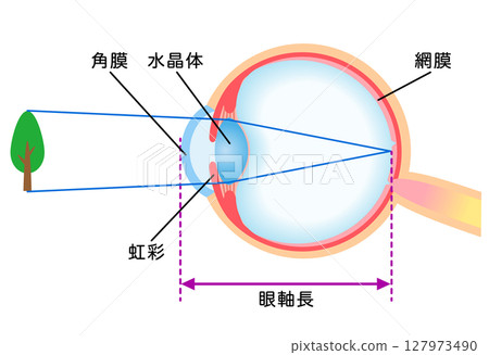 Structure of the eye: Refraction of normal vision 127973490