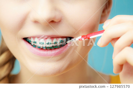 Woman with teeth braces using interdental brush Woman with teeth braces using interdental brush 127985570