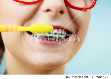 Woman with teeth braces using brush 127985573