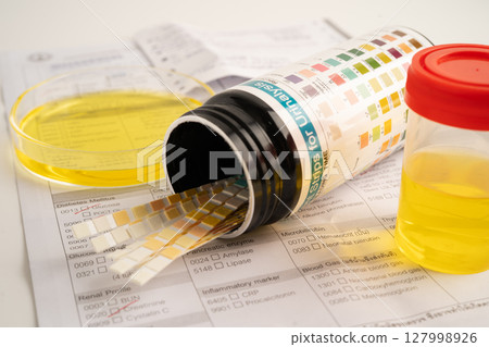 Urinalysis, urine cup with reagent strip pH paper test and comparison chart in laboratory. 127998926
