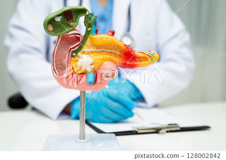 Pancreatitis, pancreatic cancer, Asian doctor with pancreas, gallbladder and bile duct human anatomy model at hospital. 128002842