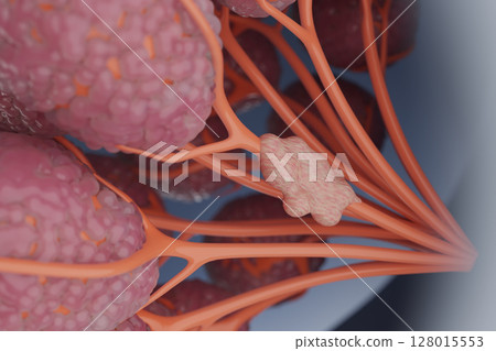 Image of cancer cell proliferation Medical CG of a tumor occurring in a breast duct 128015553