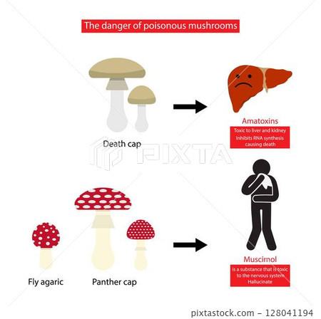 illustration of biology and medical, The dangers of poisonous mushroom poisoning, Effects of poisonous mushrooms, Liver failure and death illustration of biology and medical, The dangers of poisonous mushroom poisoning, Effects of poisonous mushrooms, Liver failure and death 128041194