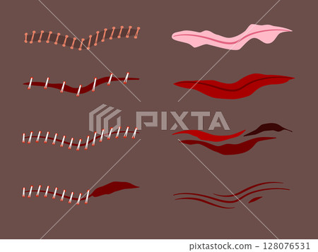 Human skin wounds including scratches scrapes abrasions vector illustrations on dark skin 128076531