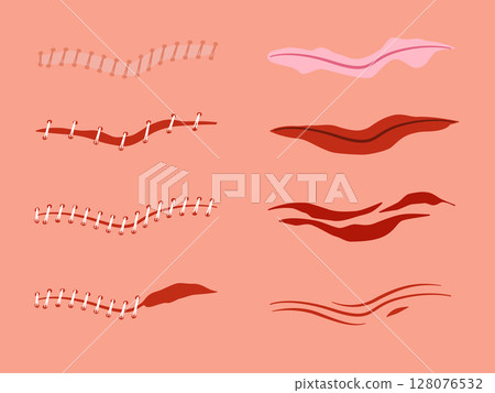 A collection of vector illustrations depicting various types of human skin wounds including scratches scrapes abrasions 128076532