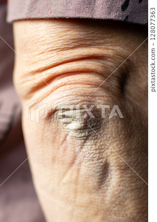 This is a closeup view of an older womans eye showcasing wrinkles This is a closeup view of an older womans eye showcasing wrinkles 128077363