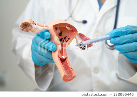 Uterus, doctor holding human anatomy model for study diagnosis and treatment in hospital. 128096446