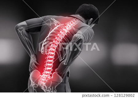 Back Pain X-ray Illustration Back Pain X-ray Illustration 128129802