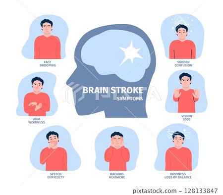 Brain stroke symptoms. Warning blood pressure signs, problems with brain diagnostic medical poster. Healthcare infographics for first aid, recent vector banner 128133847