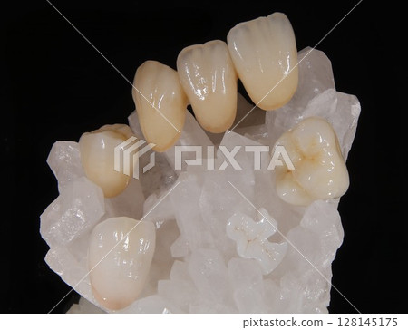 Quartz cluster and zirconia crown 128145175