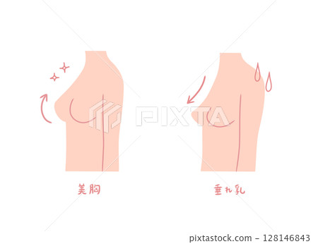 一組側面描繪了擁有美麗乳房和下垂乳房的女人的插圖 一組側面描繪了擁有美麗乳房和下垂乳房的女人的插圖 128146843
