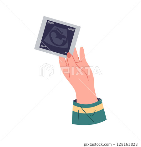 Hand with ultrasound scan of unborn baby. Vector prenatal checkup result in sonogram format. Fetal development and pregnancy monitoring, medical examination and pregnant healthcare. Motherhood. 128163828