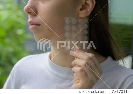 Close up of a young woman holding a transparent pimple patch set near her acne prone cheek. Concept of skincare, healing, dermatology, facial care, youth and gentle cosmetic treatment. 128170314