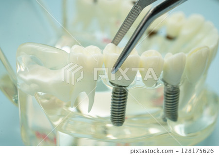 Dental teeth model with dentist tool for dentistry. 128175626