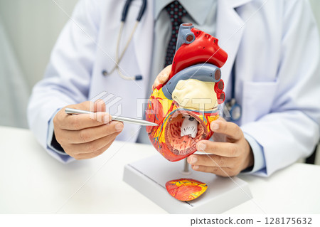 Cardiovascular disease CVD, Asian doctor holding human anatomy model for learn and treat heart disease. 128175632