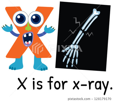 Playful Alphabet X with X-Ray Illustration 128179170