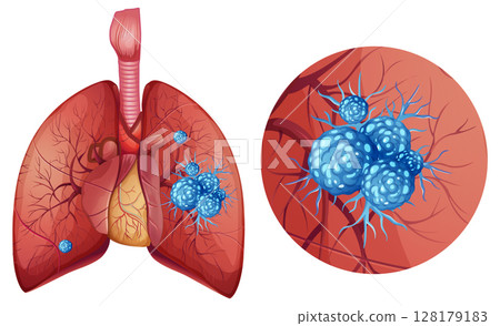 Detailed Vector Illustration of Lung Anatomy and Cells Detailed Vector Illustration of Lung Anatomy and Cells 128179183