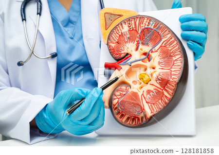 Chronic kidney disease, doctor with model for treatment urinary system, urology, Estimated glomerular filtration rate eGFR. Chronic kidney disease, doctor with model for treatment urinary system, urology, Estimated glomerular filtration rate eGFR. 128181858