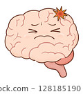 Cerebral hemorrhage (color) 128185190