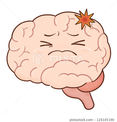 Cerebral hemorrhage (color) 128185190