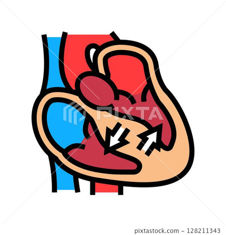 hypertrophic cardiomyopathy cardiology color icon vector illustration hypertrophic cardiomyopathy cardiology color icon vector illustration 128211343