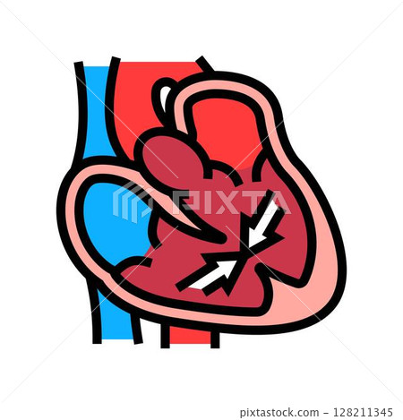 cardiomyopathy cardiology disease color icon vector illustration cardiomyopathy cardiology disease color icon vector illustration 128211345