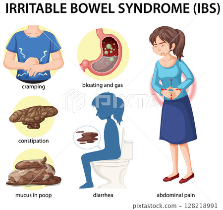 Irritable Bowel Syndrome Symptoms and Effects Illustration Irritable Bowel Syndrome Symptoms and Effects Illustration 128218991