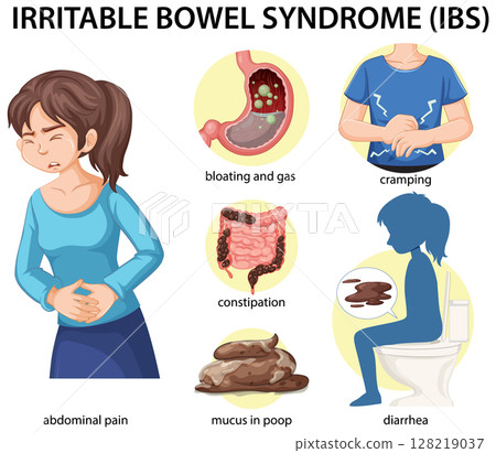 Irritable Bowel Syndrome Symptoms Illustration 128219037