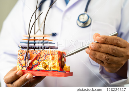 Asian dermatologist doctor holding skin structure model anatomy for treatment in hospital, hair transplant. Asian dermatologist doctor holding skin structure model anatomy for treatment in hospital, hair transplant. 128224817
