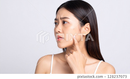 圖片中是一位未化妝、皮膚出現問題的女性。特寫照片中，一位女性的臉頰上長滿了痤瘡。 128237073