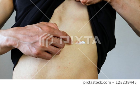 A person applying medicine to rough skin A person applying medicine to rough skin 128239443
