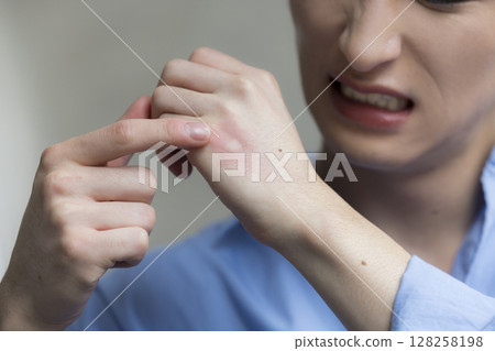 Young man bitten by mosquito 128258198