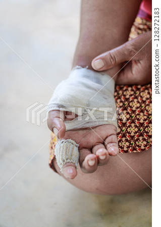 Hand of woman injured and bandaged Hand of woman injured and bandaged 128272183