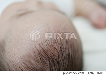 Dry scalp and dandruff in a 5-month-old baby 128293608