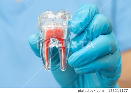 Asian dentist holding dental implant, artificial tooth roots into jaw, root canal of dental treatment, gum disease, teeth model for dentist. 128311177