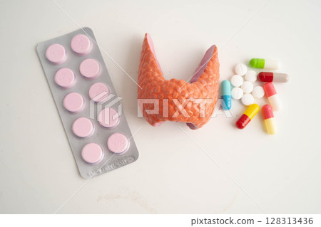 Thyroid model with pill drug treatment, Hyperthyroidism, Overactive or Lymphoma. 128313436