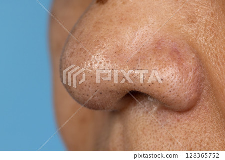 senior woman worry about enlarged pores skin and blackhead on face. 128365752