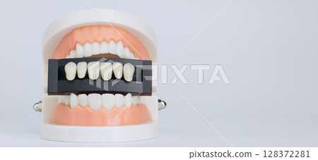 Dental model with veneer shade guide 128372281